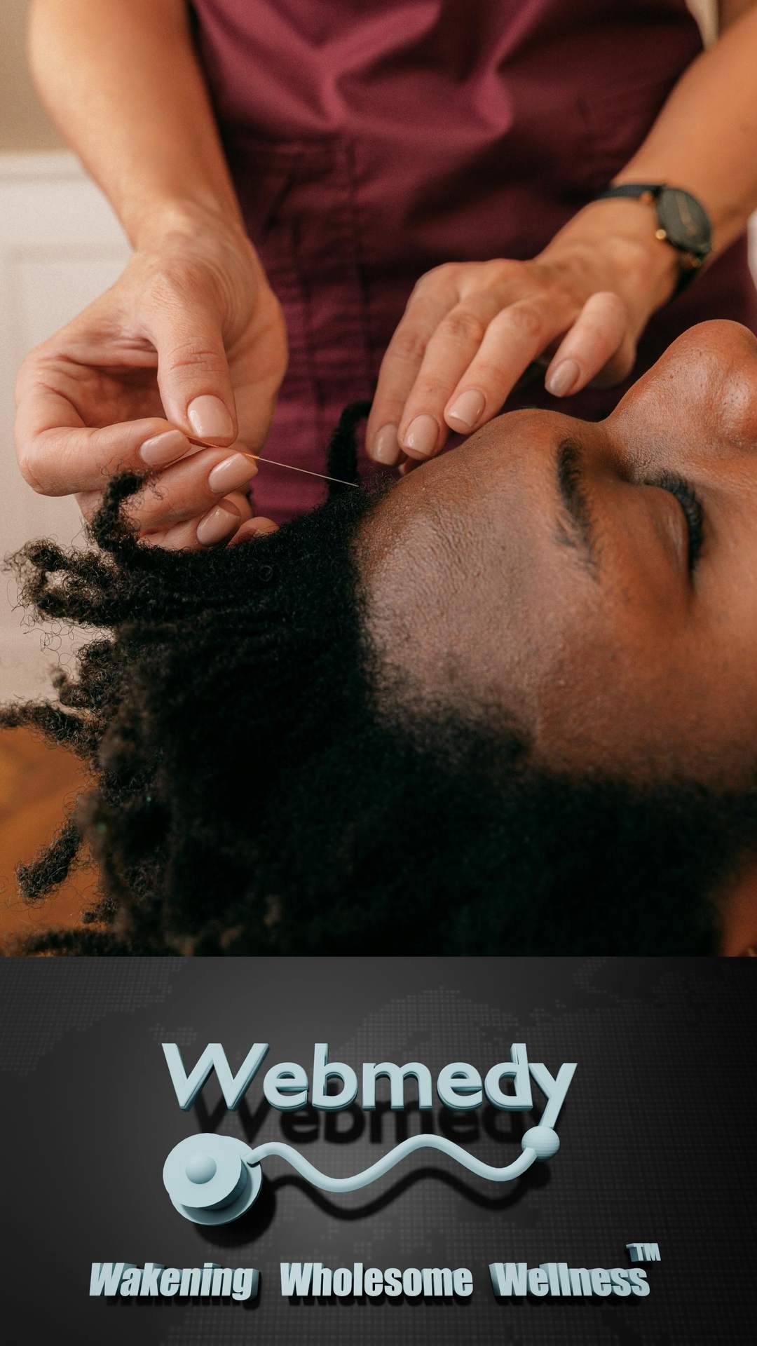 Avantages du microneedling pour la santé de la peau
